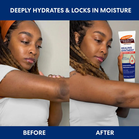 Intensive Therapy Healing Ointment